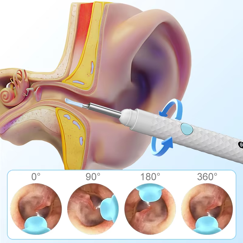 Visual Wireless Otoscope — 4.2mm 1080P Ear Camera with Wax Tools (iOS/Android) view 2